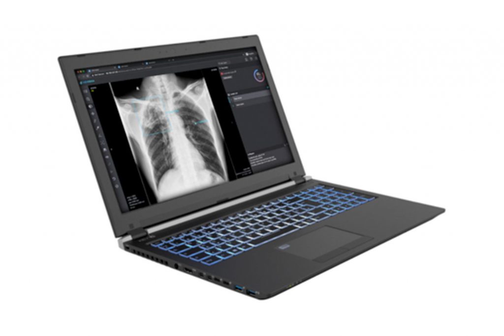 Laptop with image of an X-Ray